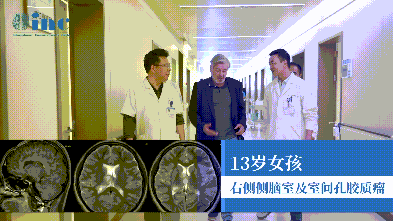 疑難膠質(zhì)瘤女孩成功示范手術(shù)“真的有幸了解到巴教授！”